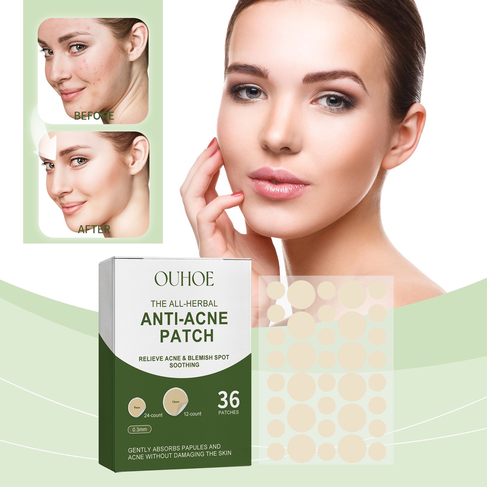 Acne Miracle Patch Removes P