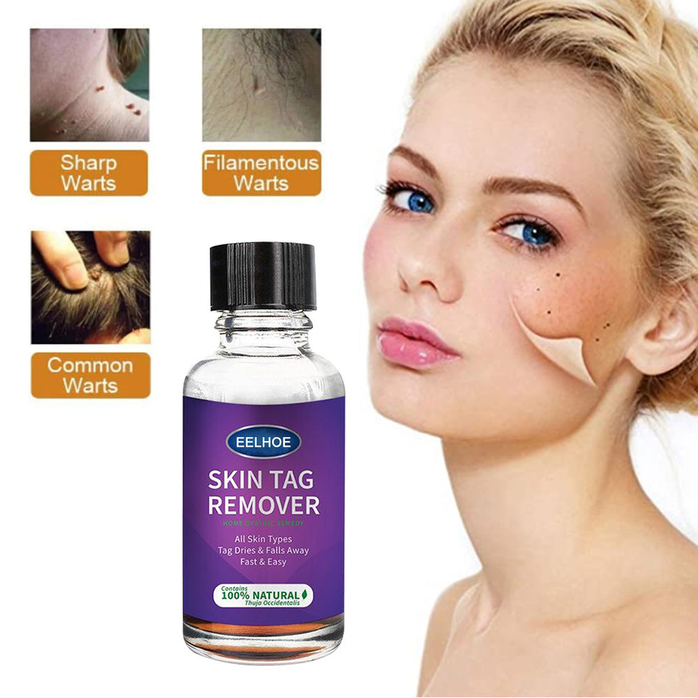 Eelhoe Skin Verrucous Remover