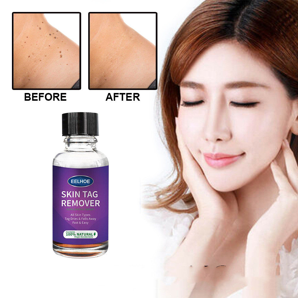 Eelhoe Skin Verrucous Remover