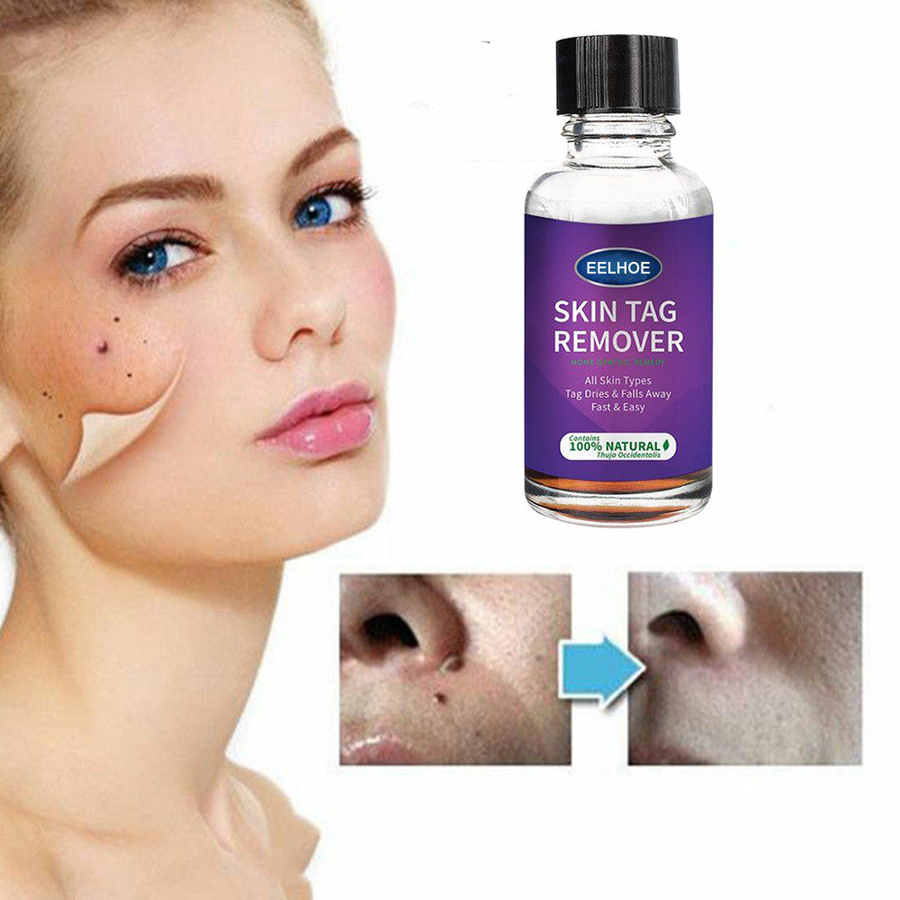 Eelhoe Skin Verrucous Remover