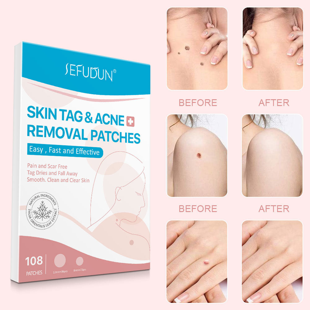Blackhead Skin Patch