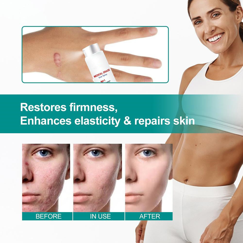 Scar Care Spray Repair Fluid