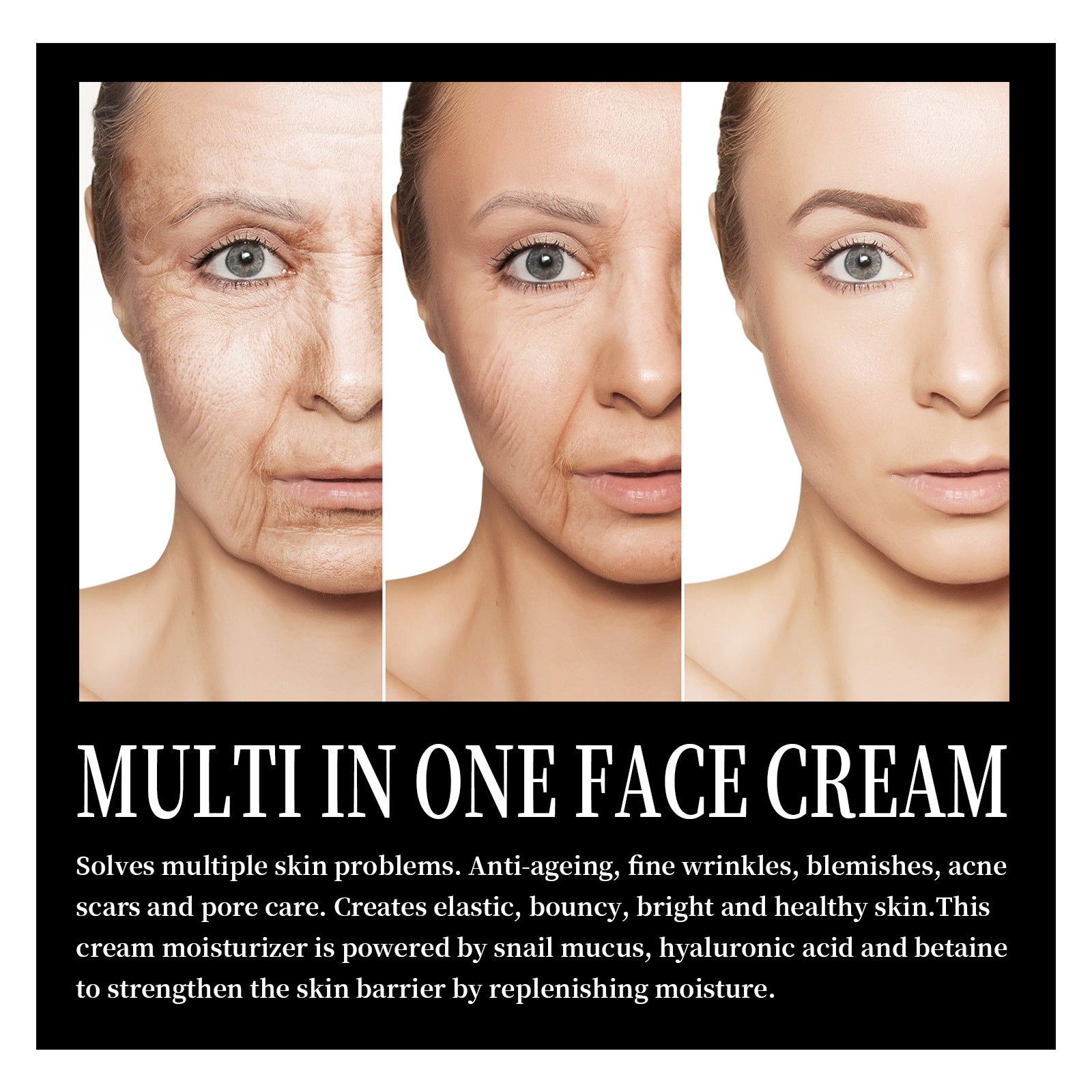 French Lines Replenishment Firming Skin Anti-Aging