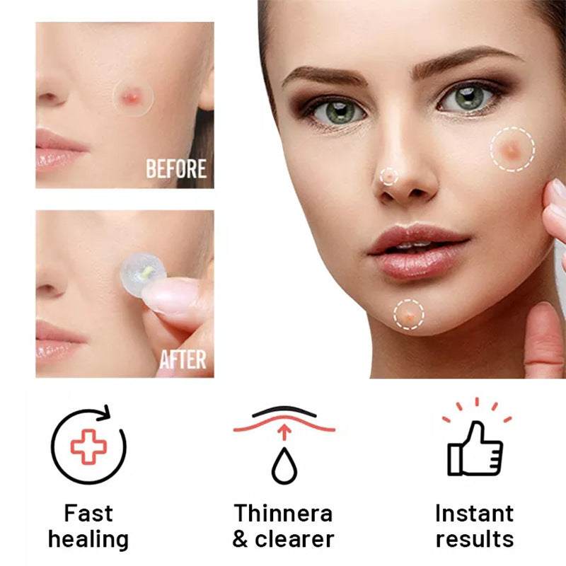 Chin Acne  Repair Patch