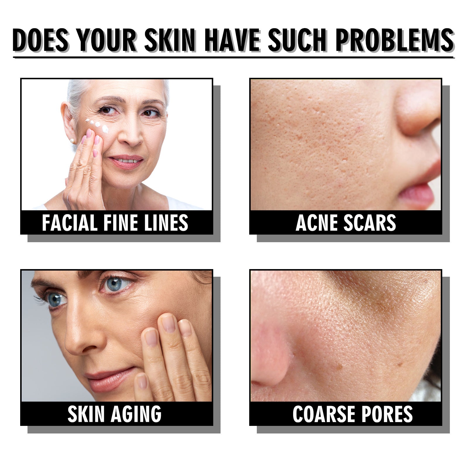 French Lines Replenishment Firming Skin Anti-Aging