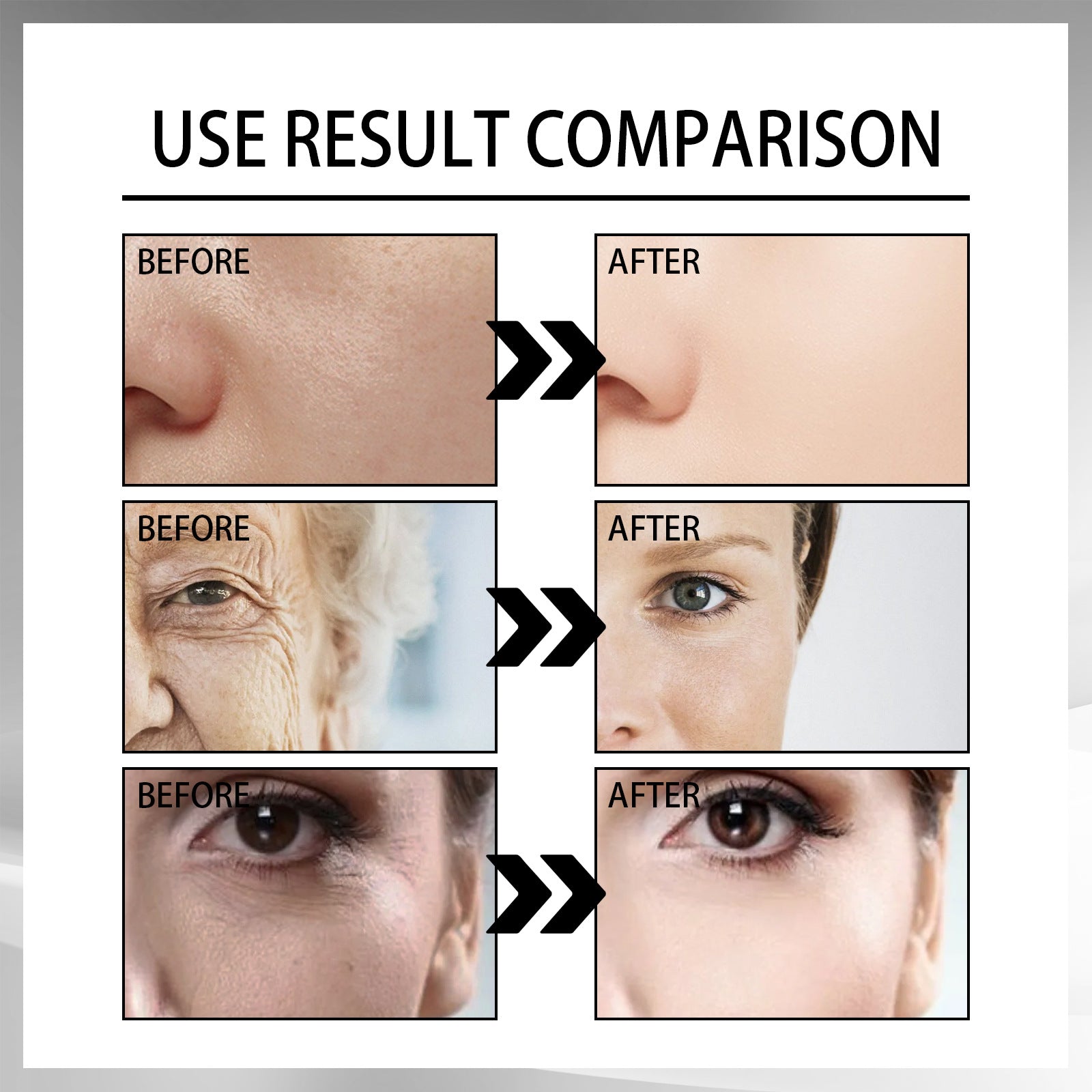 French Lines Replenishment Firming Skin Anti-Aging