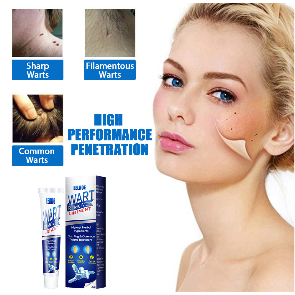 Skin care lotion Wart Removing Cream